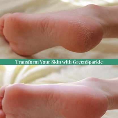 Tea Tree Bliss Foot Cream